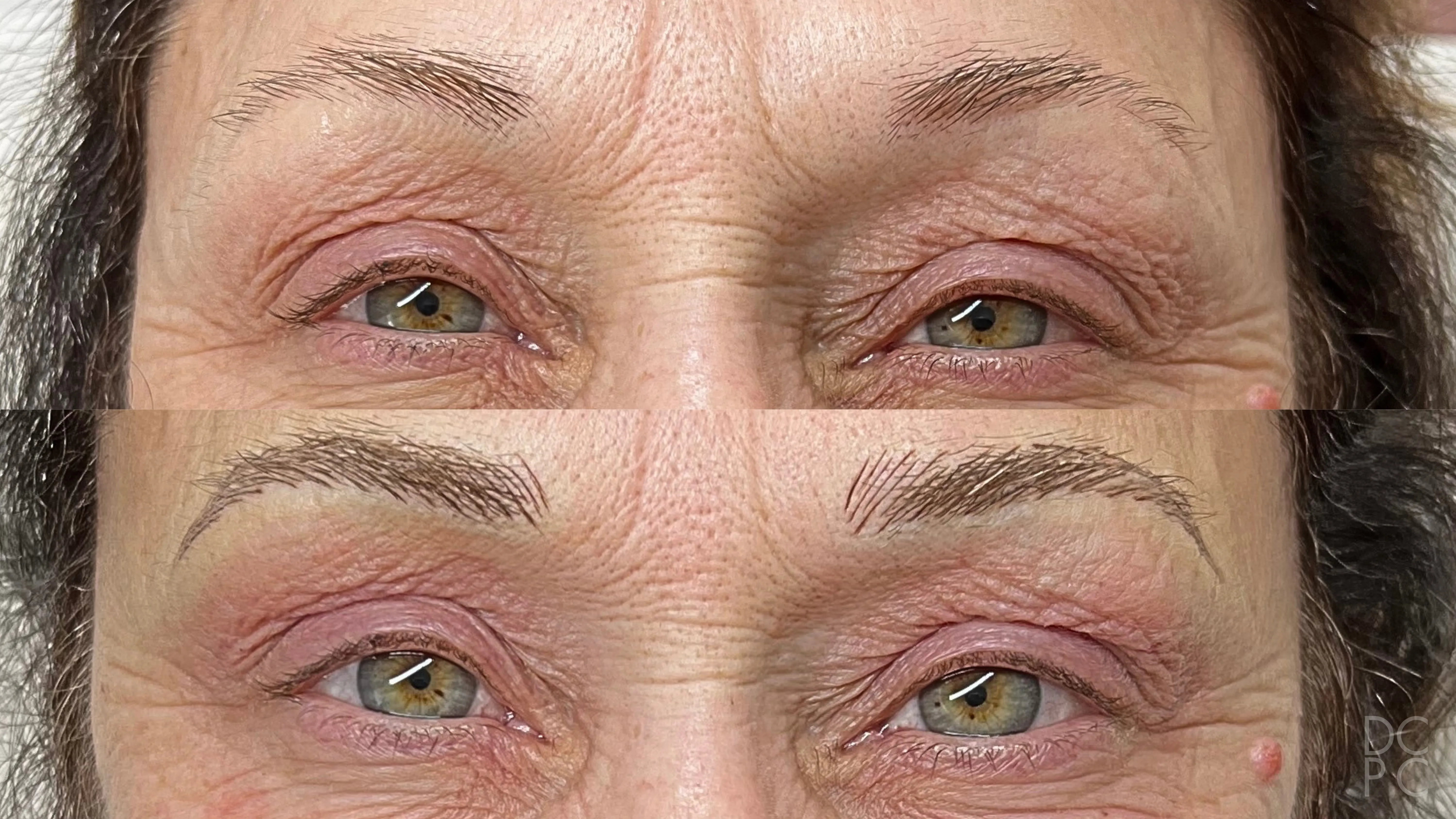 Nano brows, before and after: thin, uneven brows, then fuller, even brown brows