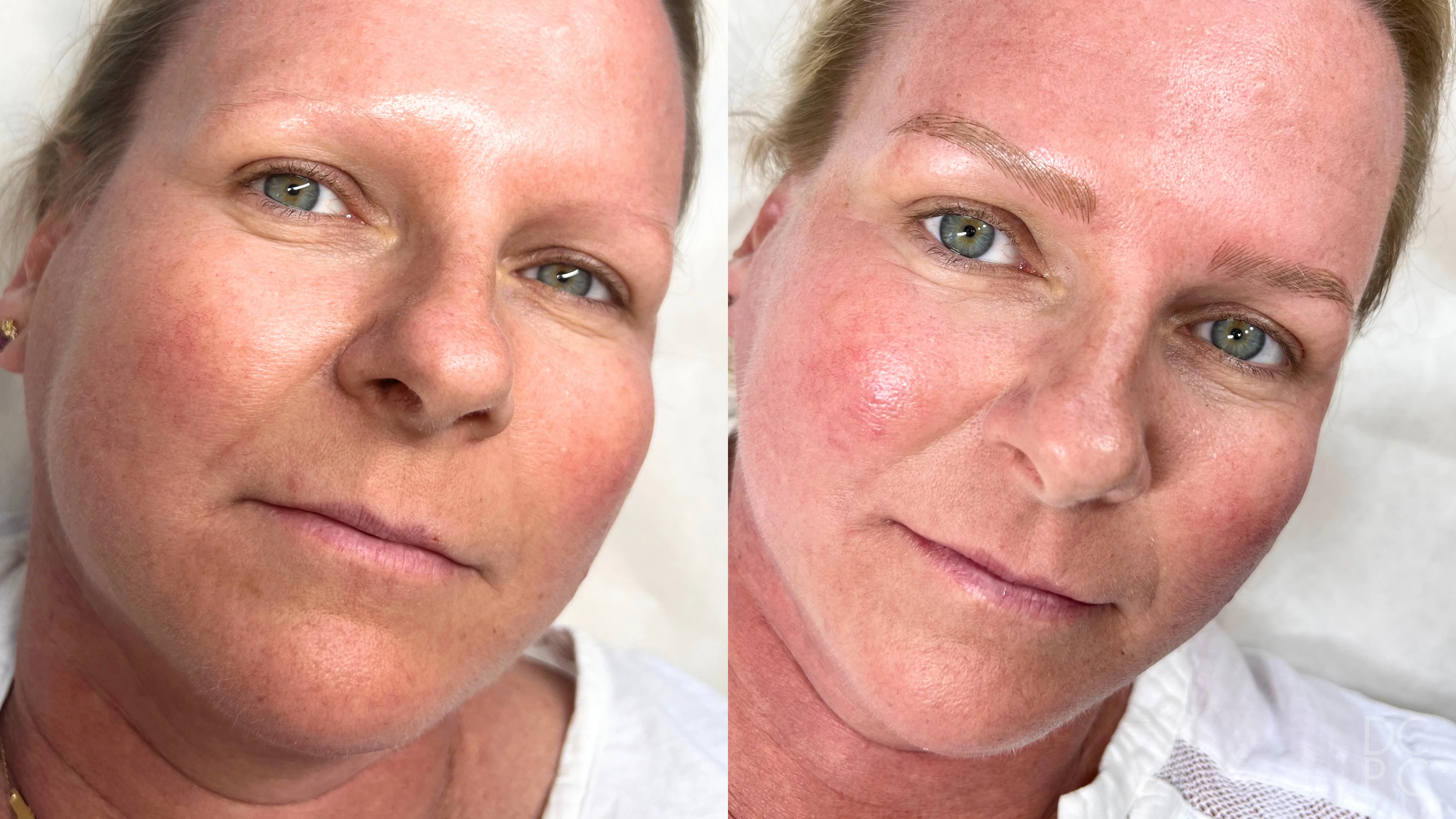 Nano brows, before and after, at an angle: faint, light brows, then soft, fuller blonde brows