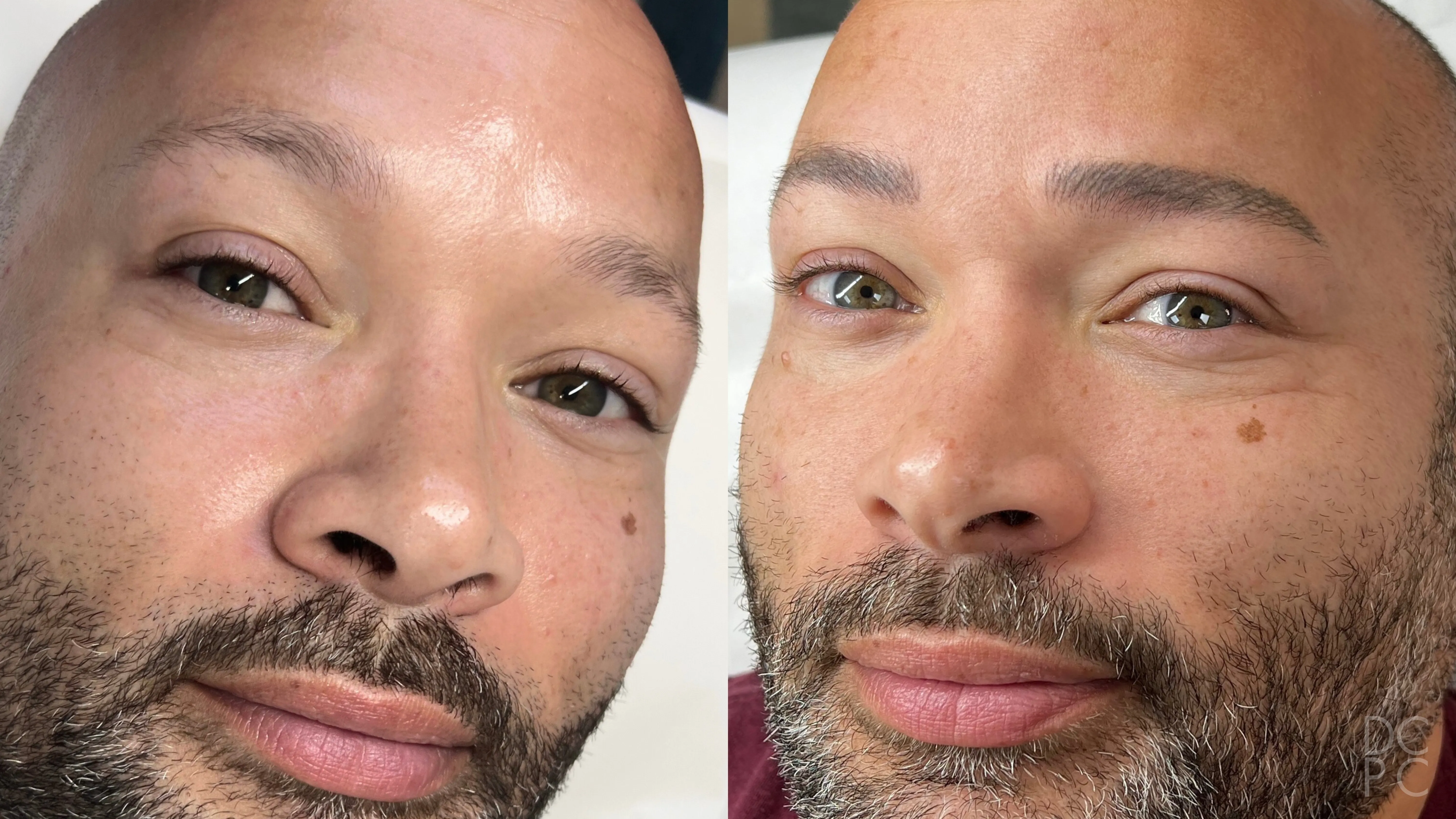 Nano brows, before and after: sparse, uneven brows, then fuller, even dark brows