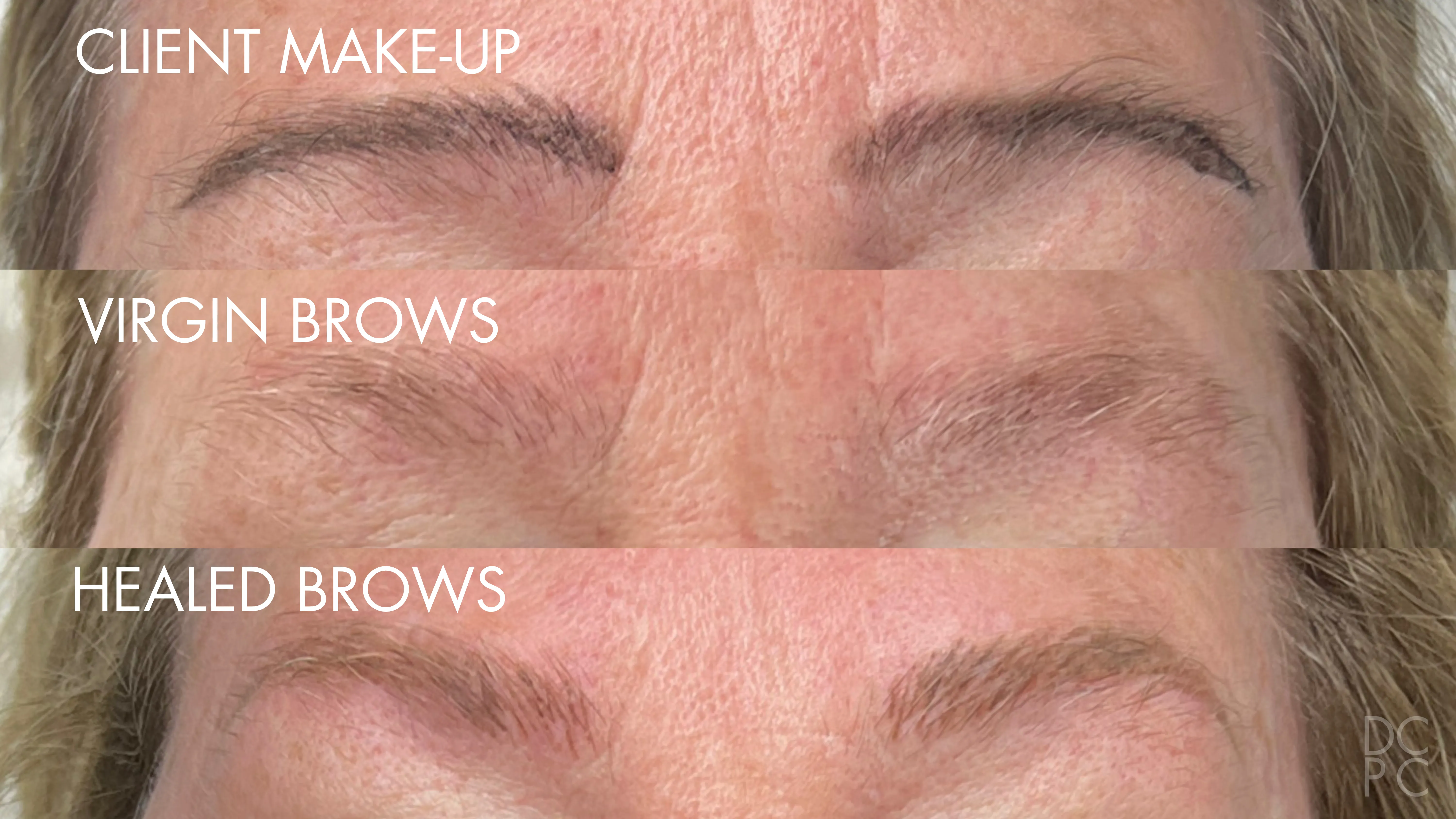 Nano brows in three stages: the client's brows filled in with makeup, then bare, then healed