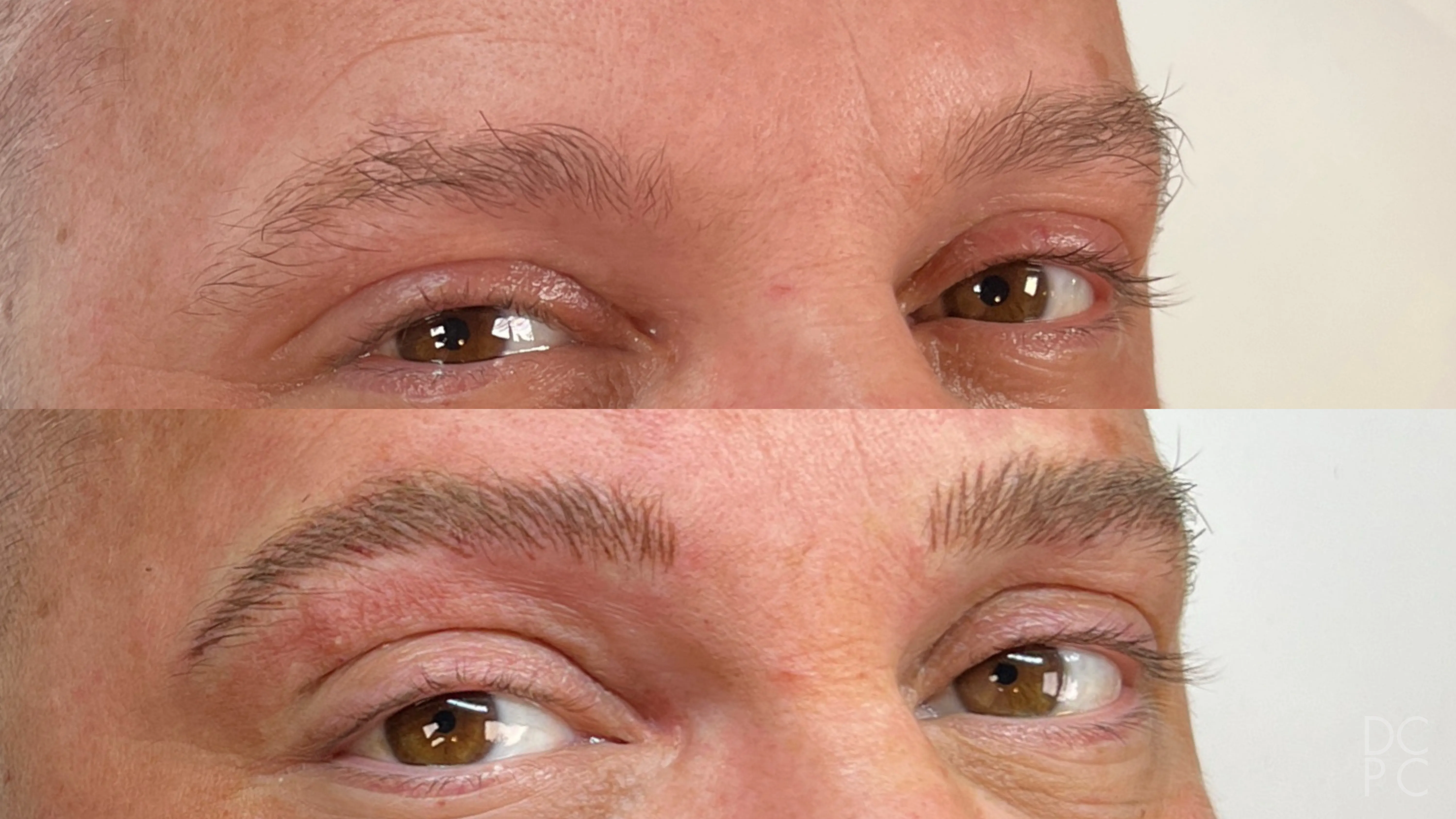 Nano brows, before and after: sparse, light brows, then fuller, soft brown brows in fine hair strokes