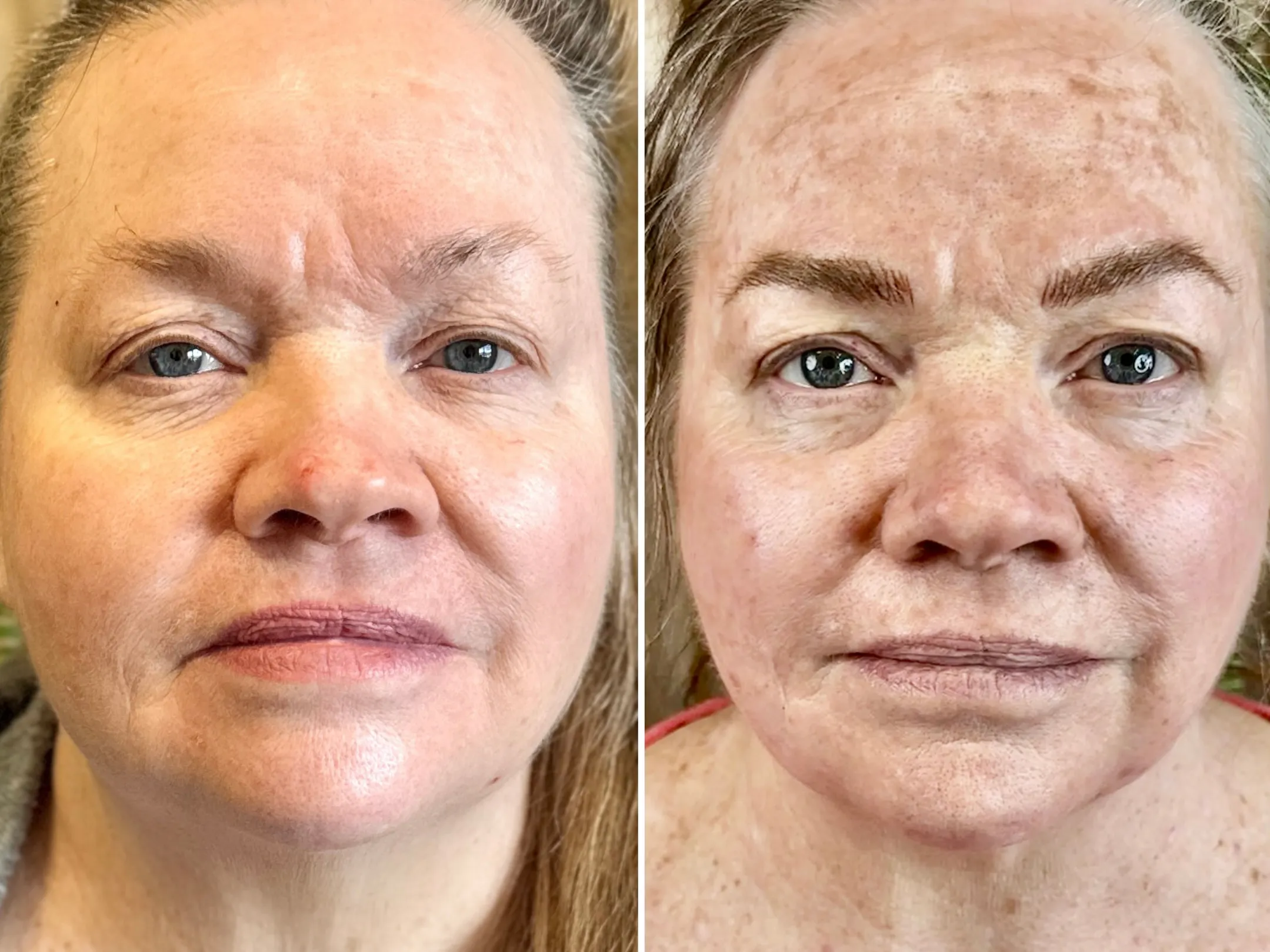 Nano brows, before and after, the full face: faint, sparse brows, then full brown brows framing the eyes