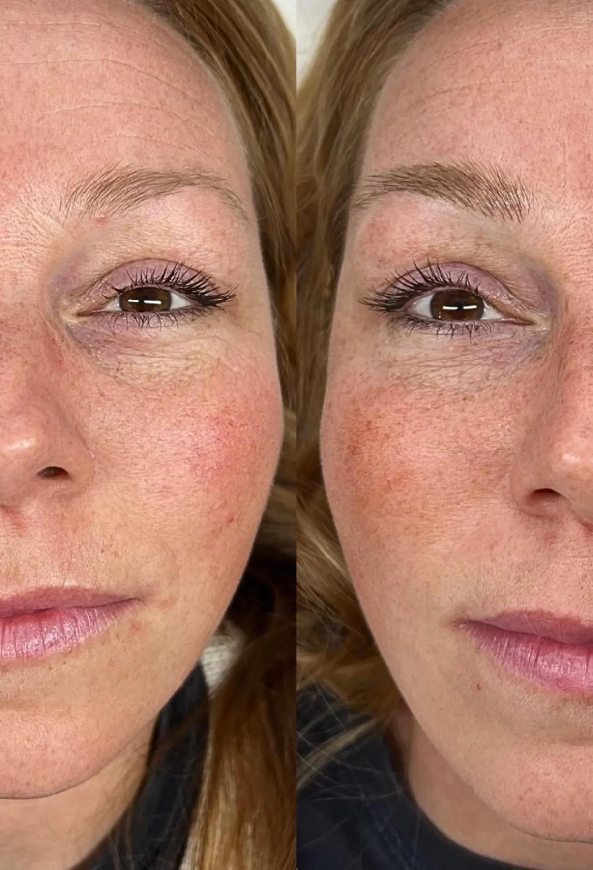 Nano brows, before and after, close and in profile: a light, sparse brow, then a fuller, defined light-brown brow
