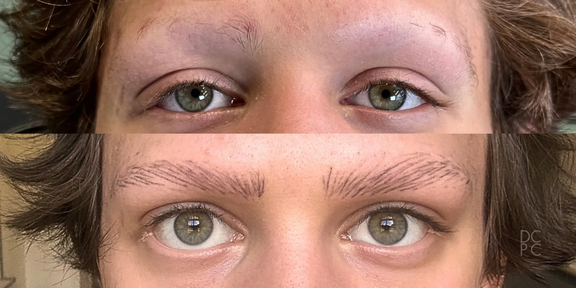 Nano brows on a client with alopecia, before and after: almost no brow hair, then full, soft brown brows in fine hair strokes