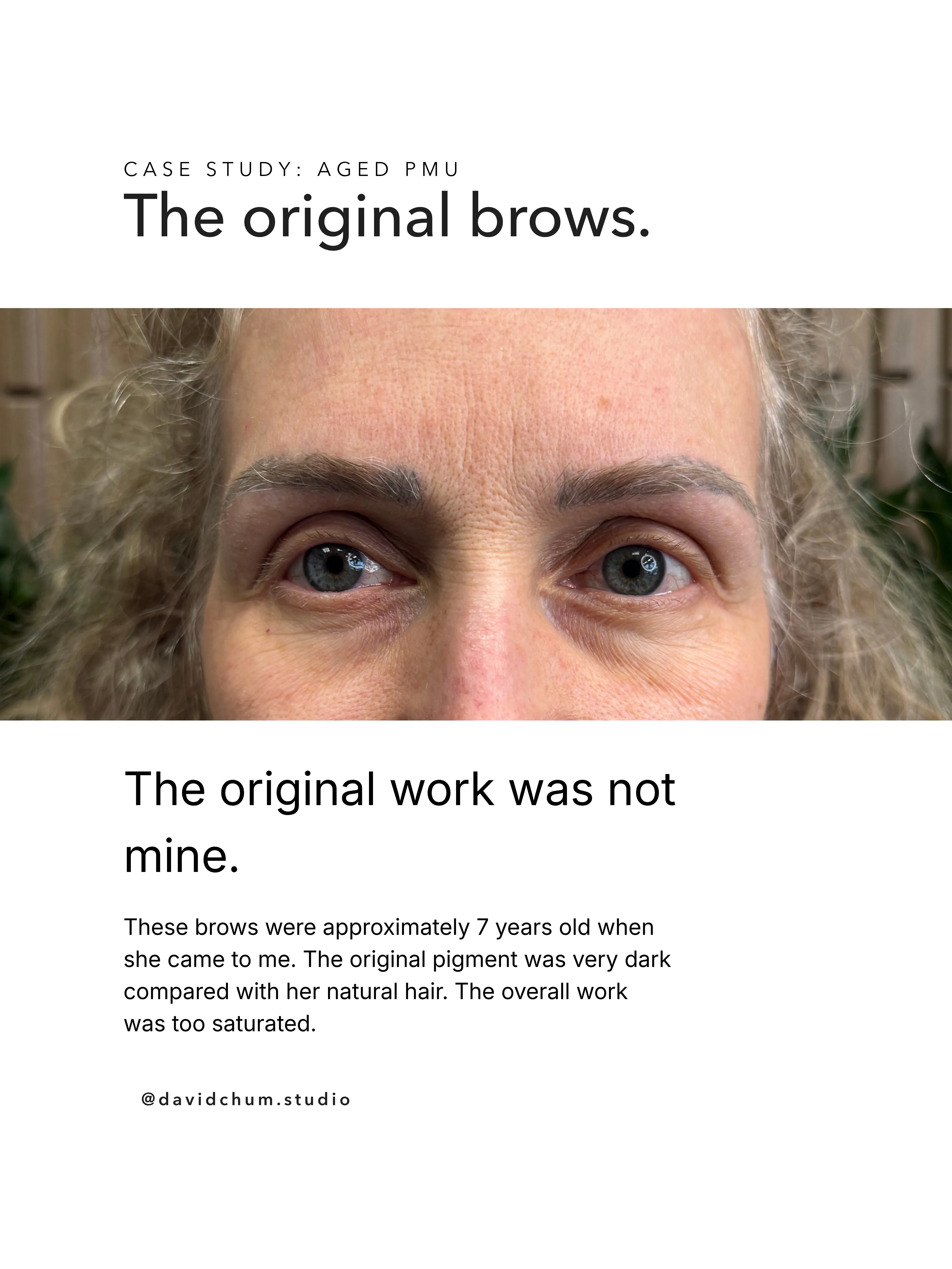 The original brows. The original work was not mine. These brows were approximately 7 years old when she came to me. The original pigment was very dark compared with her natural hair. The overall work was too saturated.