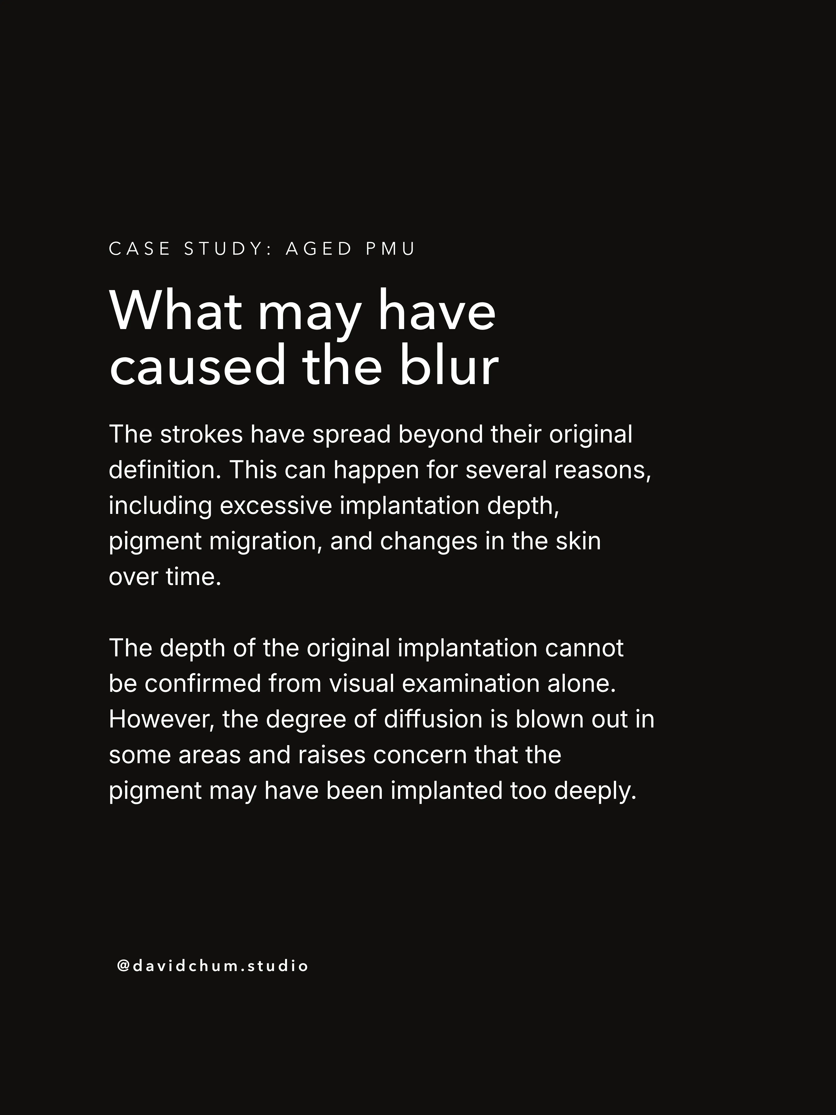 What may have caused the blur. The strokes have spread beyond their original definition. This can happen for several reasons, including excessive implantation depth, pigment migration, and changes in the skin over time.