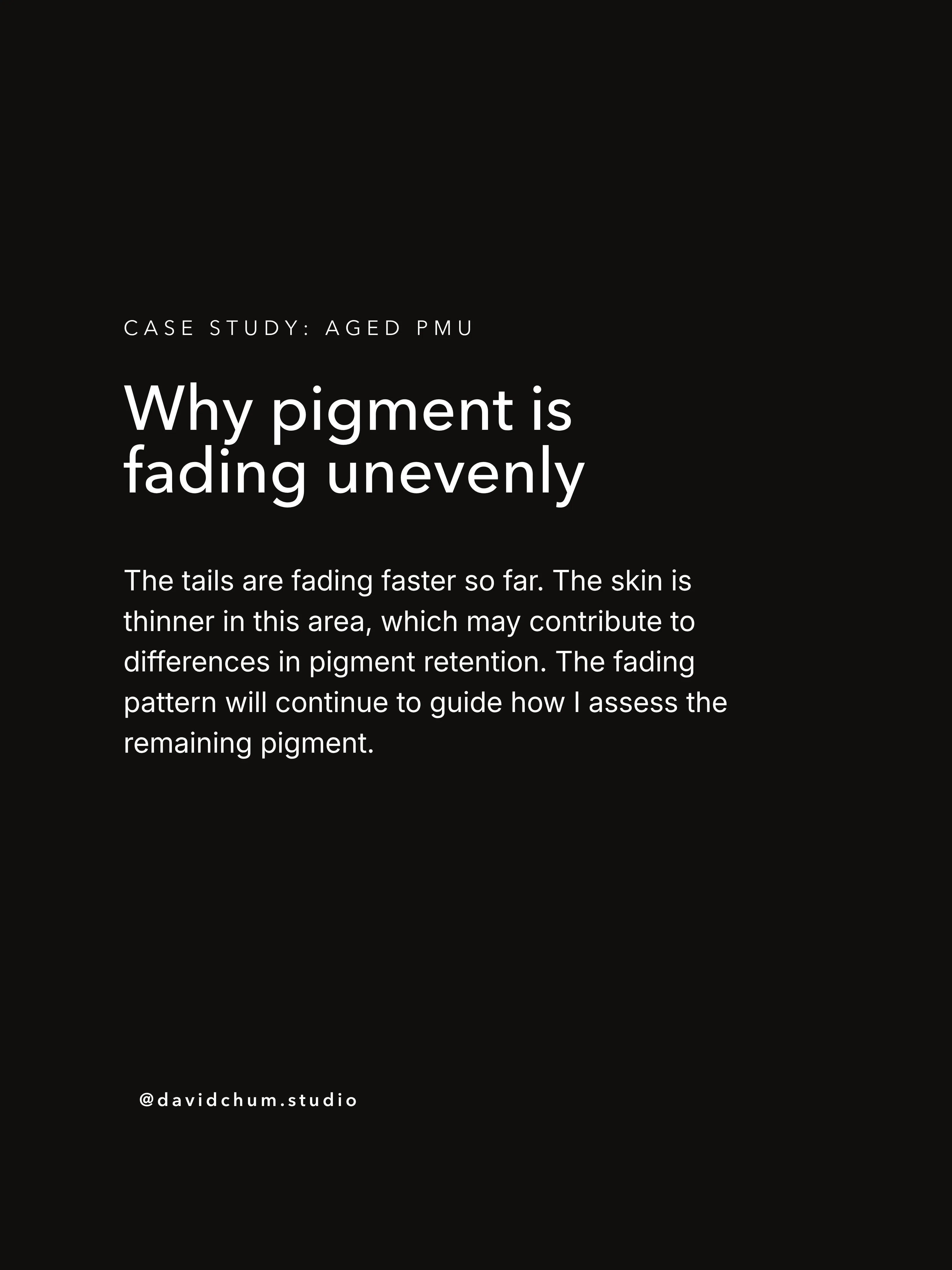 Why pigment is fading unevenly: the tails are fading faster so far. The skin is thinner in this area, which may contribute to differences in pigment retention.