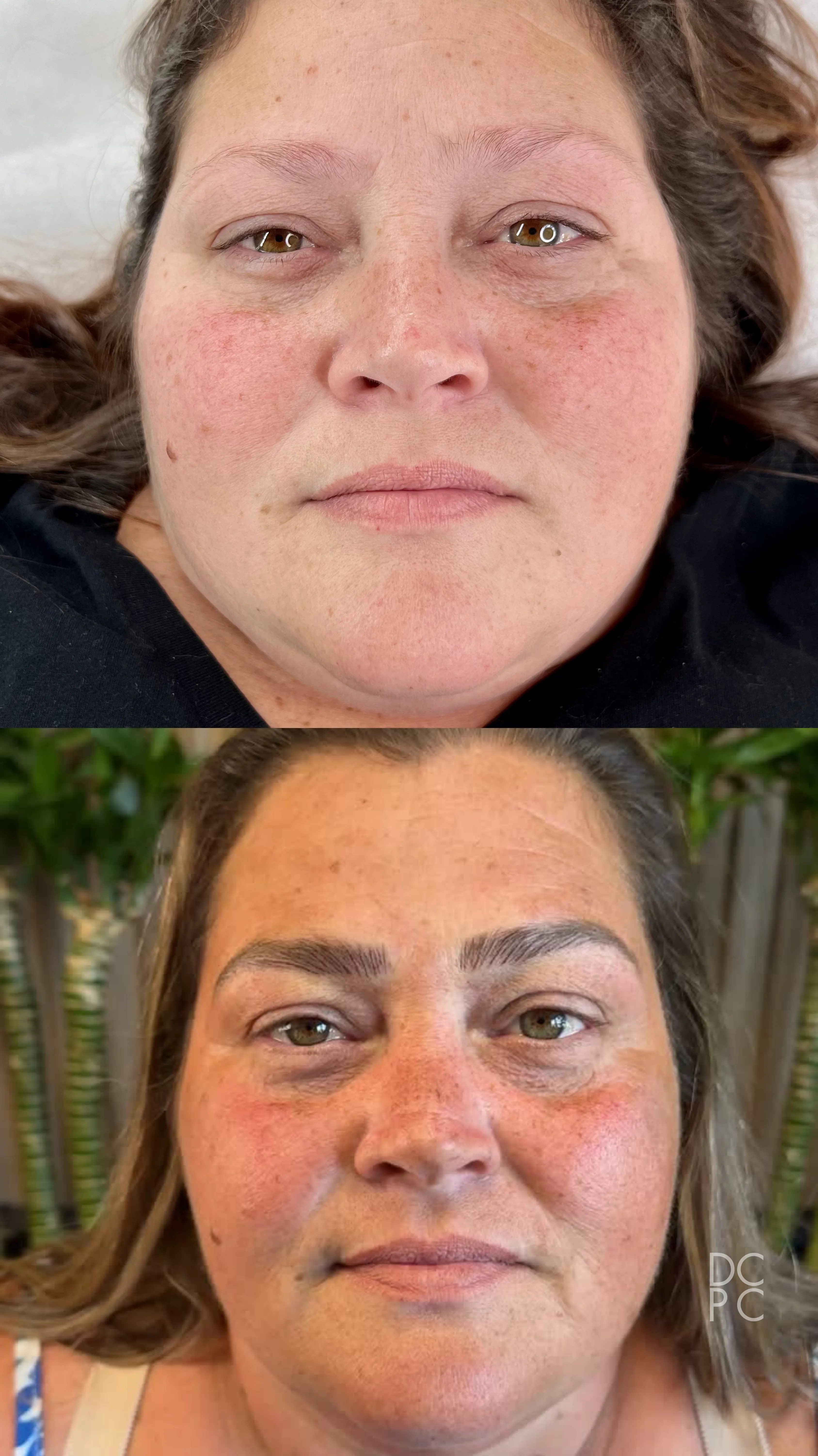 DCPC client — caucasian woman before and after nano brows
