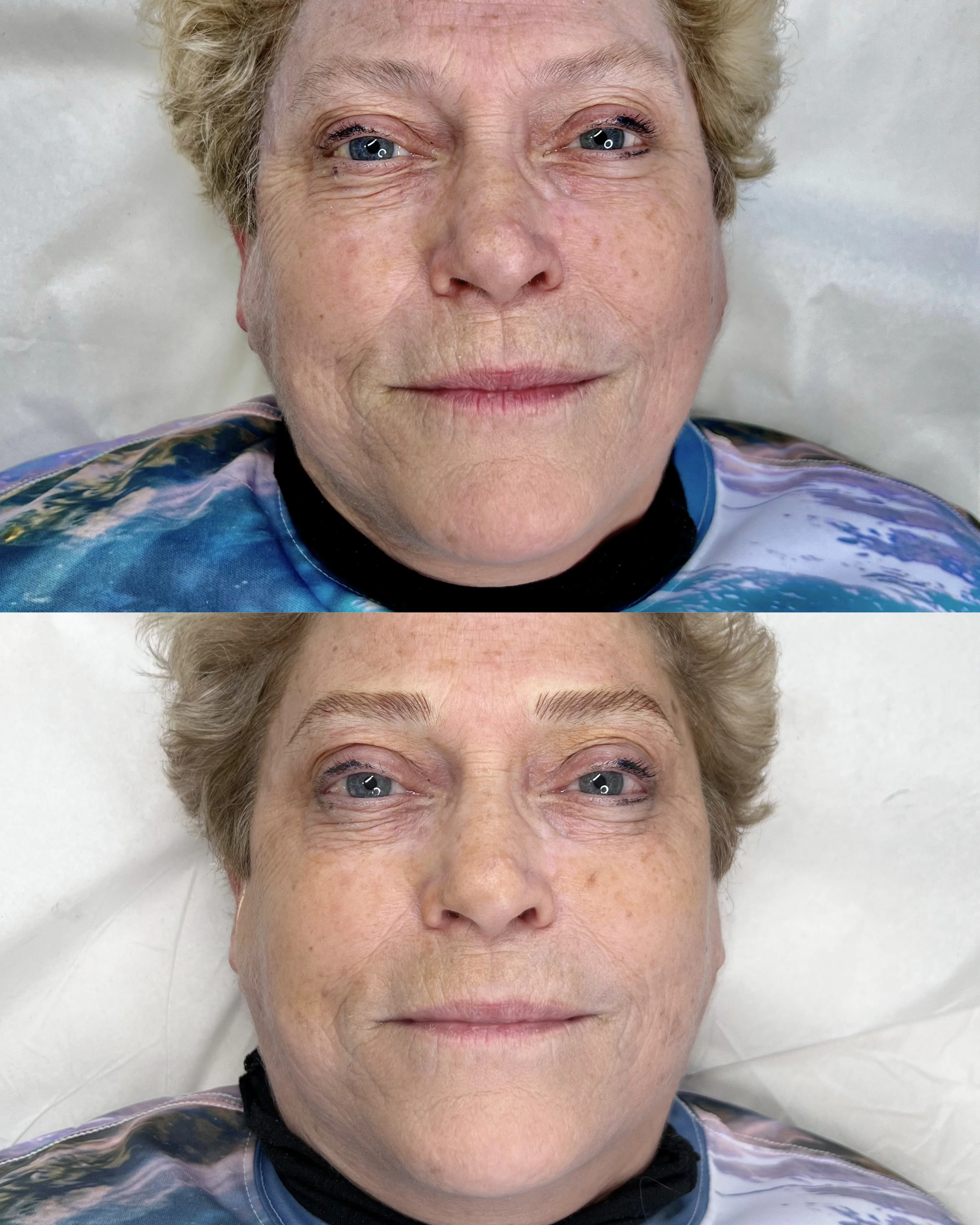 DCPC client — mature blonde woman nano brows