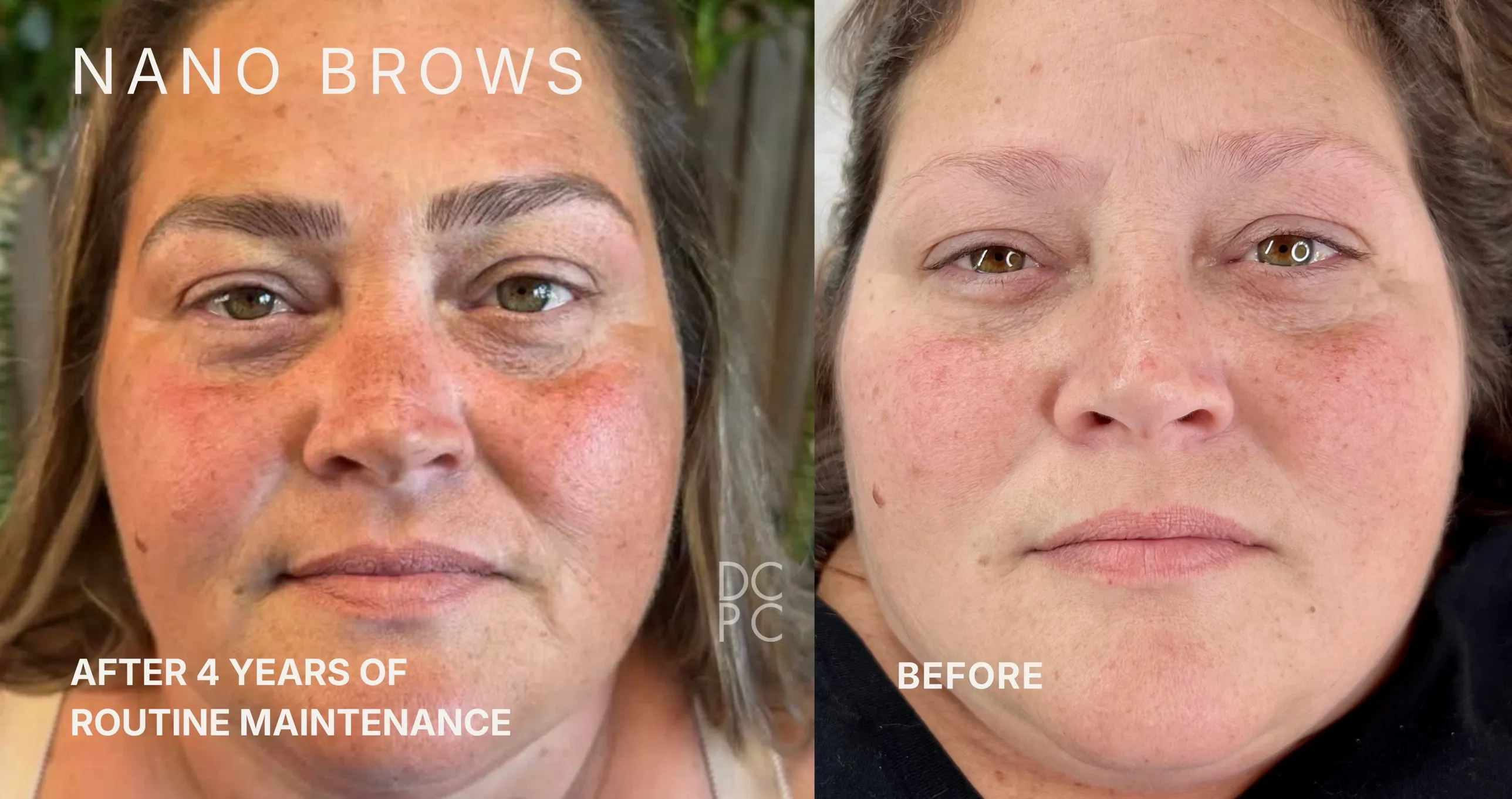 Nano brows on the same client after four years of routine maintenance, and before: full, soft brown brows on the left; faint, sparse brows on the right